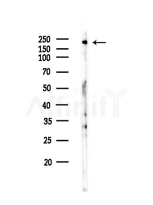 Phospho-BCL9L (Ser915) Antibody - Western blot analysis of lysates from COLO205 cells(heat-shock,45min treatment), using Phospho-BCL9L (Ser915) Antibody at 1/1000 dilution.
