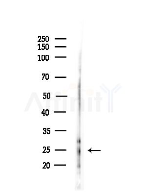 Phospho-Bim (Ser77) Antibody - Western blot analysis of lysates from PC12 cells(starvation,24h treatment), using Phospho-Bim (Ser77) Antibody at 1/1000 dilution.