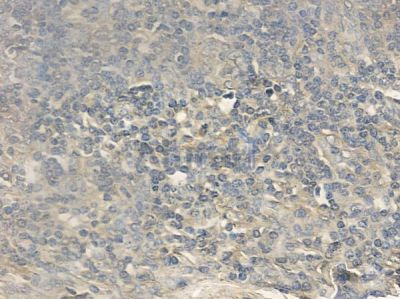 Phospho-CBL (Tyr700) Antibody - AF2328 at 1/100 staining human normal tonsil tissue by IHC-P.