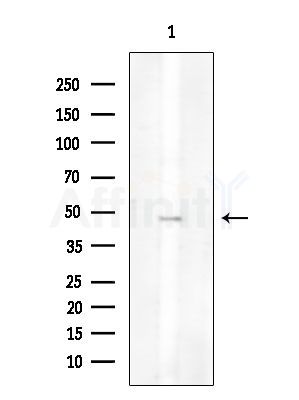 Phospho-CD79A (Tyr182) Antibody - Western blot analysis of extracts from COLO205 cells, using Phospho-CD79A (Tyr182) Antibody at 1/1000 dilution.