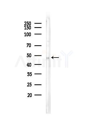 Phospho-CD79A (Tyr182) Antibody - Western blot analysis of lysates from COLO205 cells, using Phospho-CD79A (Tyr182) Antibody at 1/1000 dilution.