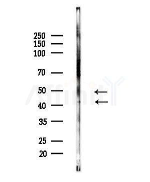 Phospho-Cyclin E1 (Thr77) Antibody - Western blot analysis of lysates from Mouse brain, using Phospho-Cyclin E1 (Thr77) Antibody at 1/1000 dilution.