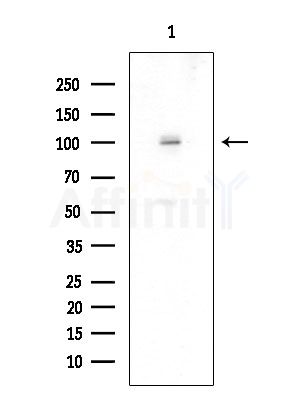 Phospho-Dab1 (Tyr220) Antibody - Western blot analysis of extracts from COLO205 cells, using Phospho-Dab1 (Tyr220) Antibody at 1/1000 dilution.