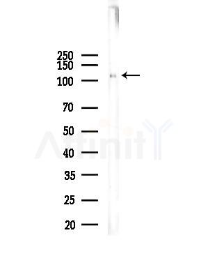 Phospho-Dab1 (Tyr220) Antibody - Western blot analysis of lysates from COLO205 cells, using Phospho-Dab1 (Tyr220) Antibody at 1/1000 dilution.