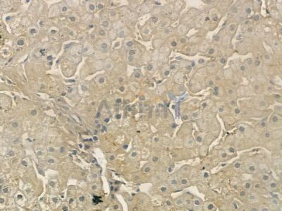 Phospho-DDR1 (Tyr513) Antibody - AF2337 at 1/100 staining human normal liver tissue by IHC-P.