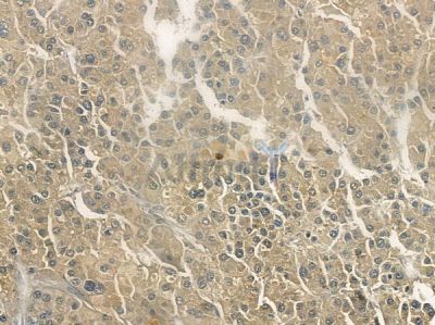 Phospho-DR6 (Ser562) Antibody - AF2339 at 1/100 staining human normal lung tissue by IHC-P.