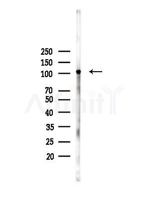 Phospho-eEF2k (Ser366) Antibody - Western blot analysis of lysates from Hela cells(heat-shock,45min treatment), using Phospho-eEF2k (Ser366) Antibody at 1/1000 dilution.