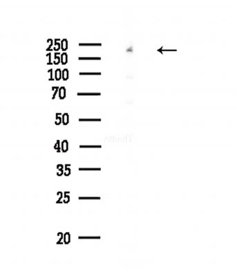 Phospho-eIF4G1 (Ser1147) Antibody - Western blot analysis of lysates from COLO205 cells(heat-shock,45min treatment), using Phospho-eIF4G1 (Ser1147) Antibody at 1/1000 dilution.