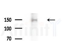 Phospho-Flt3 / CD135 (Tyr969) Antibody - Western blot analysis of extracts from EC304 cells(heat-shock,45min treatment), using Phospho-Flt3 / CD135 (Tyr969) Antibody at 1/1000 dilution.