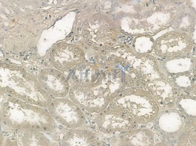 Phospho-Flt3 / CD135 (Tyr969) Antibody - AF2342 at 1/100 staining human normal kidney tissue by IHC-P.