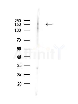 Phospho-Flt3 / CD135 (Tyr969) Antibody - Western blot analysis of lysates from EC304 cells(heat-shock,45min treatment), using Phospho-Flt3 / CD135 (Tyr969) Antibody at 1/1000 dilution.