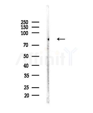 Phospho-GRB10 (Ser476) Antibody - Western blot analysis of lysates from Mouse brain, using Phospho-GRB10 (Ser476) Antibody at 1/1000 dilution.