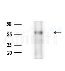 Phospho-JunB (Thr102/Thr104) Antibody - Western blot analysis of extracts from Rat brain, using Phospho-JunB (Thr102/Thr104) Antibody at 1/1000 dilution.