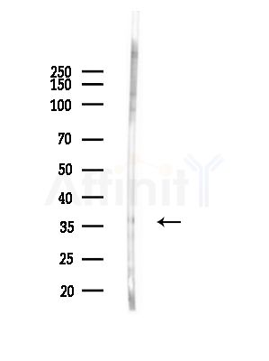 Phospho-JunB (Thr102/Thr104) Antibody - Western blot analysis of lysates from Rat brain, using Phospho-JunB (Thr102/Thr104) Antibody at 1/1000 dilution.