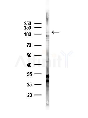 Phospho-KSR1(Ser392) Antibody - Western blot analysis of lysates from COLO205 cells, using Phospho-KSR1(Ser392) Antibody at 1/1000 dilution.