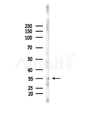 Phospho-LAT (Tyr200) Antibody - Western blot analysis of lysates from B16F10-LUC cells(LPS, 4h treatment), using Phospho-LAT (Tyr200) Antibody at 1/1000 dilution.