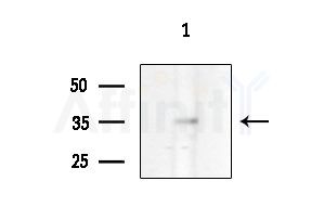 Phospho-MEF2A (Ser408) Antibody - Western blot analysis of extracts from Mouse brain, using Phospho-MEF2A (Ser408) Antibody at 1/1000 dilution.