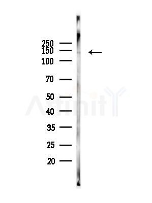 Phospho-MYPT1 (Thr696) Antibody - Western blot analysis of lysates from COS-7 cells(heat-shock,45min treatment), using Phospho-MYPT1 (Thr696) Antibody at 1/1000 dilution.