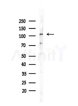 Phospho-NEDD4L (Ser448) Antibody - Western blot analysis of lysates from Mouse lung, using Phospho-NEDD4L (Ser448) Antibody at 1/1000 dilution.