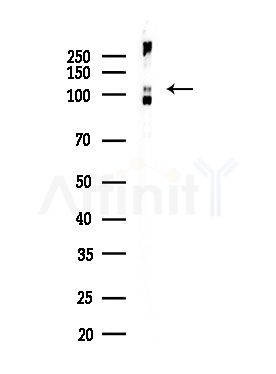 Phospho-NEDD4L (Ser448) Antibody - Western blot analysis of lysates from EC304 cells, using Phospho-NEDD4L (Ser448) Antibody at 1/1000 dilution.