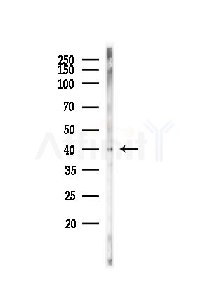 Phospho-Nucleophosmin (Thr95) Antibody - Western blot analysis of lysates from Mouse testis, using Phospho-Nucleophosmin (Thr95) Antibody at 1/1000 dilution.