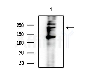 Phospho-NuMA (Thr2055) Antibody - Western blot analysis of extracts from EC304 cells, using Phospho-NuMA (Thr2055) Antibody at 1/1000 dilution.