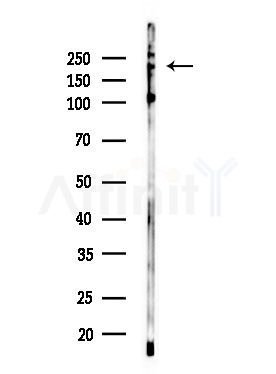 Phospho-NuMA (Thr2055) Antibody - Western blot analysis of lysates from EC304 cells, using Phospho-NuMA (Thr2055) Antibody at 1/1000 dilution.