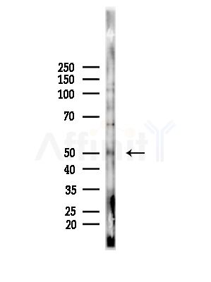 Phospho-p53 (Thr81) Antibody - Western blot analysis of lysates from B16F10-LUC cells(LPS, 4h treatment), using Phospho-p53 (Thr81) Antibody at 1/1000 dilution.