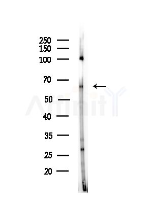Phospho-PAK1 /PAK2 (Ser199/Ser204, Ser192/Ser197) Antibody - Western blot analysis of lysates from PC12 cells(starvation,24h treatment), using Phospho-PAK1 /PAK2 (Ser199/Ser204, Ser192/Ser197) Antibody at 1/1000 dilution.