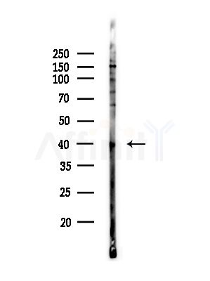 Phospho-PBK/TOPK (Thr9) Antibody - Western blot analysis of lysates from COLO205 cells(heat-shock,45min treatment), using Phospho-PBK/TOPK (Thr9) Antibody at 1/1000 dilution.