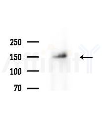 Phospho-PLC beta 3 (Ser1105) Antibody - Western blot analysis of extracts from A375 cells(starvation treatment), using Phospho-PLC beta 3 (Ser1105) Antibody at 1/1000 dilution.