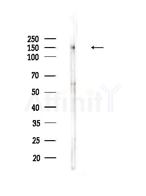 Phospho-PLC beta 3 (Ser1105) Antibody - Western blot analysis of lysates from A375 cells(starvation,24h treatment), using Phospho-PLC beta 3 (Ser1105) Antibody at 1/1000 dilution.