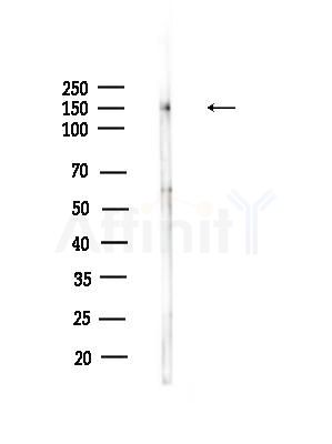 Phospho-PLC beta 3 (Ser1105) Antibody - Western blot analysis of lysates from A375 cells(starvation,24h treatment), using Phospho-PLC beta 3 (Ser1105) Antibody at 1/1000 dilution.