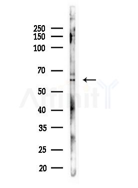 Phospho-PLK1 (Thr210) Antibody - Western blot analysis of lysates from EC304 cells, using Phospho-PLK1 (Thr210) Antibody at 1/1000 dilution.