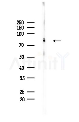 Phospho-REPS1 (Ser709) Antibody - Western blot analysis of lysates from Mouse brain, using Phospho-REPS1 (Ser709) Antibody at 1/1000 dilution.