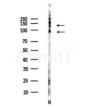 Phospho-SHIP1 (Tyr1020)[Tyr1022] Antibody - Western blot analysis of lysates from COLO205 cells(UV,30min treatment), using Phospho-SHIP1 (Tyr1020)[Tyr1022] Antibody at 1/1000 dilution.