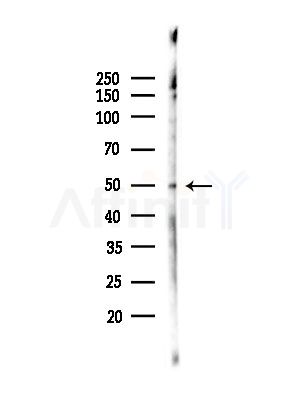 Phospho-SKP2/p45 (Ser64) Antibody - Western blot analysis of lysates from A375 cells(heat-shock,45min treatment), using Phospho-SKP2/p45 (Ser64) Antibody at 1/1000 dilution.