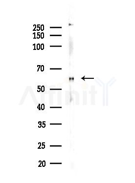 Phospho-Smad1 (Ser206) Antibody - Western blot analysis of lysates from EC304 cells, using Phospho-Smad1 (Ser206) Antibody at 1/1000 dilution.