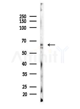 Phospho-SQSTM1/p62 (Ser349) Antibody - Western blot analysis of lysates from EC304 cells, using Phospho-SQSTM1/p62 (Ser349) Antibody at 1/1000 dilution.