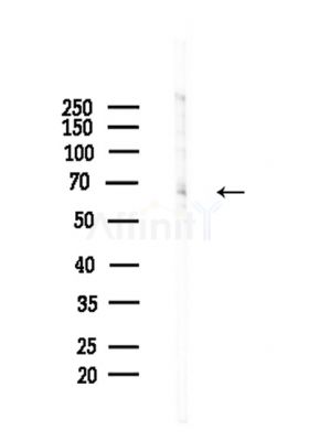 Phospho-SQSTM1/p62 (Thr269/Ser272) Antibody - Western blot analysis of lysates from Mouse brain, using Phospho-SQSTM1/p62 (Thr269/Ser272) Antibody at 1/1000 dilution.