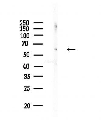 Phospho-SQSTM1/p62 (Thr269/Ser272) Antibody - Western blot analysis of lysates from COLO205 cells(heat-shock,45min treatment), using Phospho-SQSTM1/p62 (Thr269/Ser272) Antibody at 1/1000 dilution.