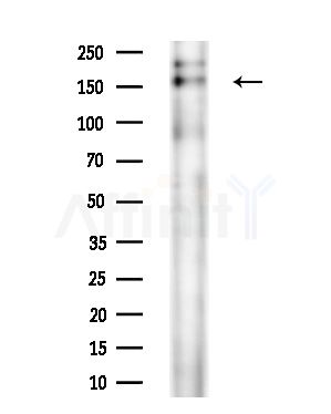 Phospho-SRC3 (Thr24) Antibody - Western blot analysis of extracts from Rat brain, using Phospho-SRC3 (Thr24) Antibody at 1/1000 dilution.