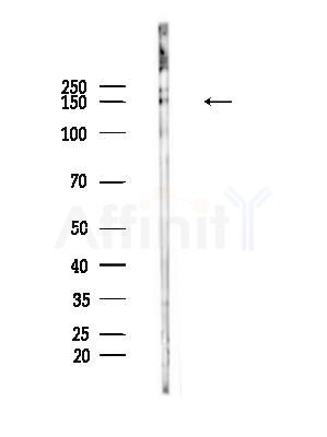 Phospho-SRC3 (Thr24) Antibody - Western blot analysis of lysates from Rat brain, using Phospho-SRC3 (Thr24) Antibody at 1/1000 dilution.