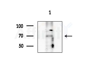 Phospho-SYK (Ser297) Antibody - Western blot analysis of extracts from EC304 cells, using Phospho-SYK (Ser297) Antibody at 1/1000 dilution.