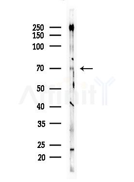 Phospho-SYK (Ser297) Antibody - Western blot analysis of lysates from EC304 cells, using Phospho-SYK (Ser297) Antibody at 1/1000 dilution.