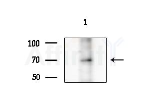 Phospho-Synapsin I (Ser605) Antibody - Western blot analysis of extracts from Rat testis, using Phospho-Synapsin I (Ser605) Antibody at 1/1000 dilution.