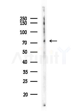 Phospho-Synapsin I (Ser605) Antibody - Western blot analysis of lysates from Rat testis, using Phospho-Synapsin I (Ser605) Antibody at 1/1000 dilution.