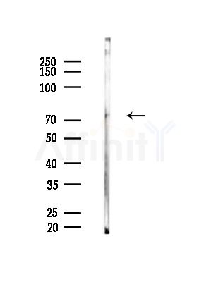 Phospho-TAK1 (Ser439) Antibody - Western blot analysis of lysates from Hela cells(UV,30min treatment), using Phospho-TAK1 (Ser439) Antibody at 1/1000 dilution.