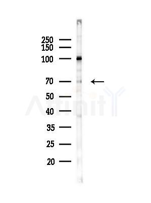 Phospho-Tau (Ser199)[Ser516] Antibody - Western blot analysis of lysates from B16F10-LUC cells(heat-shock,45min treatment), using Phospho-Tau (Ser199)[Ser516] Antibody at 1/1000 dilution.
