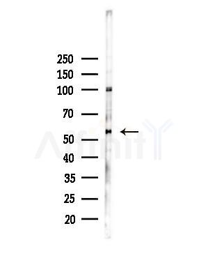 Phospho-Tau (Ser199)[Ser516] Antibody - Western blot analysis of lysates from Hela cells(heat-shock,45min treatment), using Phospho-Tau (Ser199)[Ser516] Antibody at 1/1000 dilution.